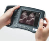 Keebomed Palm ultrasounds WED-2000AV