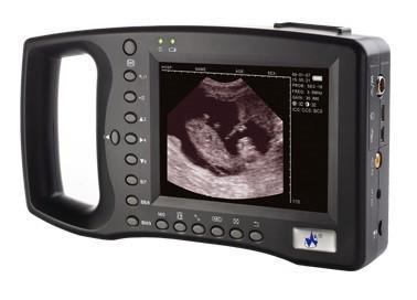 Keebomed Palm ultrasounds WED-2000AV