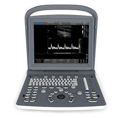 Chison ECO2Vet Portable Ultrasound | KeeboVet