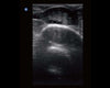 Chison ECO2Vet Portable Ultrasound | Bovine Ovary, B Mode | KeeboVet