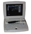 KX5000V Laptop Ultrasound Machine