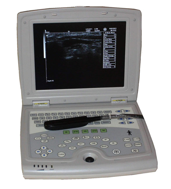 KX5000V Laptop Ultrasound Machine