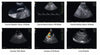Chison Q6Vet Color Doppler Ultrasound Machine Sample Images