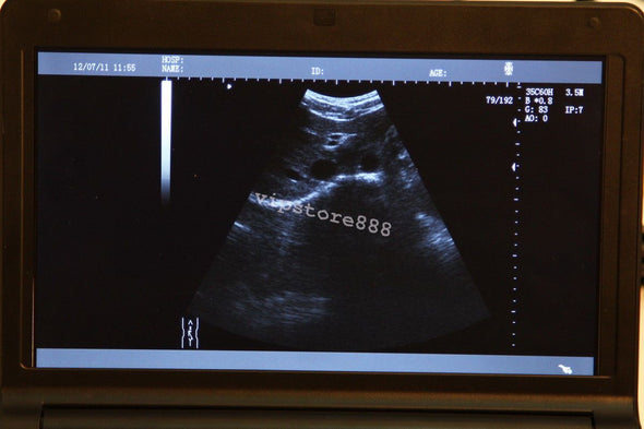 Veterinary vet Full Digital Laptop Ultrasound Scanner Micro-Convex Probe +3D FDA