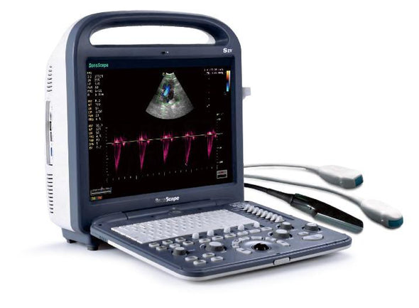 Used Sonoscape S2V Ultrasound - Deals on Veterinary Ultrasounds
 - 2