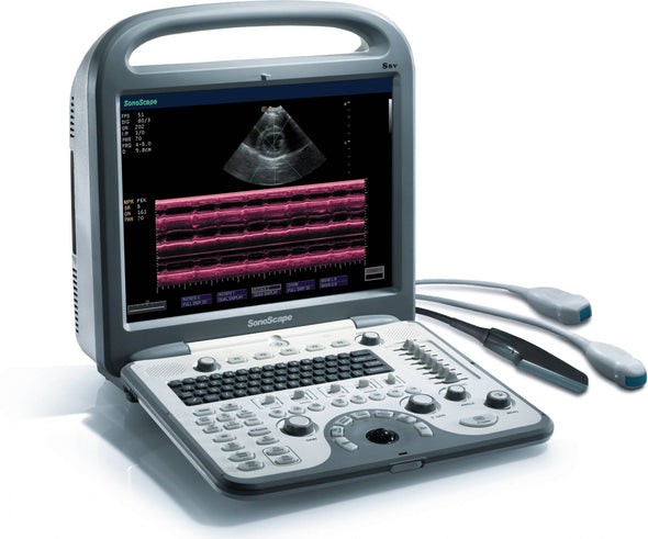 Used Sonoscape S8V Ultrasound - Deals on Veterinary Ultrasounds

