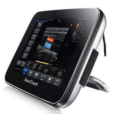 Chison Sonotouch 30